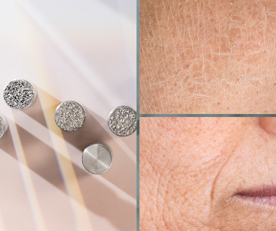 Diamond Glow Facial Diamond-Glow-Facial results